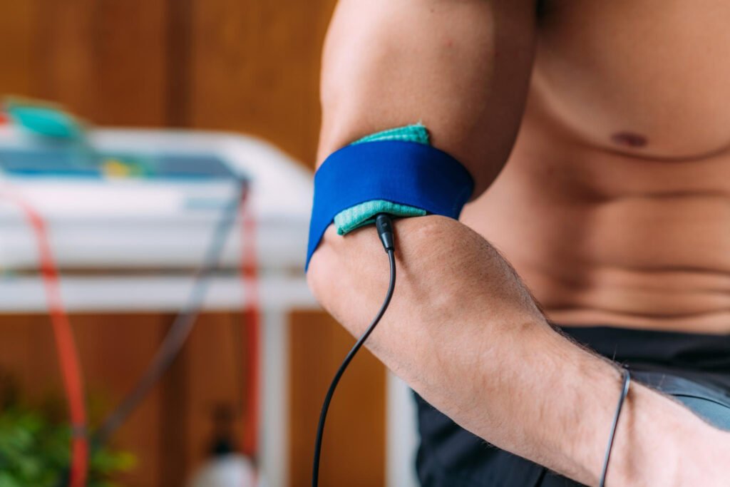 TENS (TRANSCUTANEOUS ELECTRICAL NERVE STIMULATION)